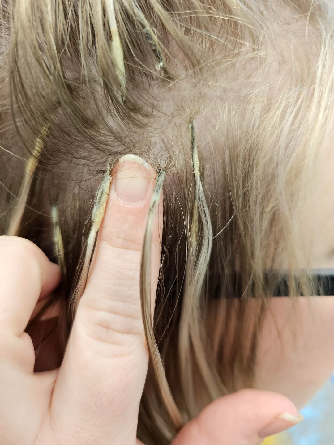 Removal-All Ring Link Extensions